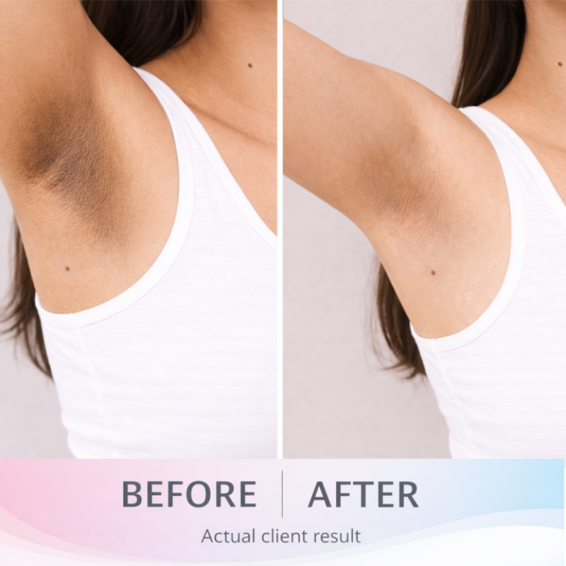 DermalMD® Intimate Lightening Cream – Gentle Brightening & Even Tone Care